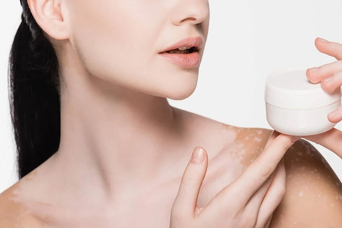 Cosmelan Peel:[] What are the Conditions Treated and Risks Associated with It? []