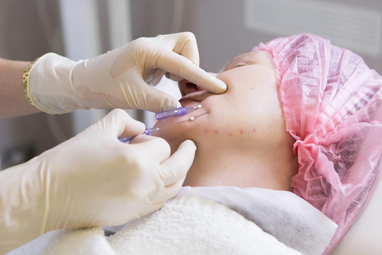 What Are Pdo Threads?[] How Long Does It Last? []