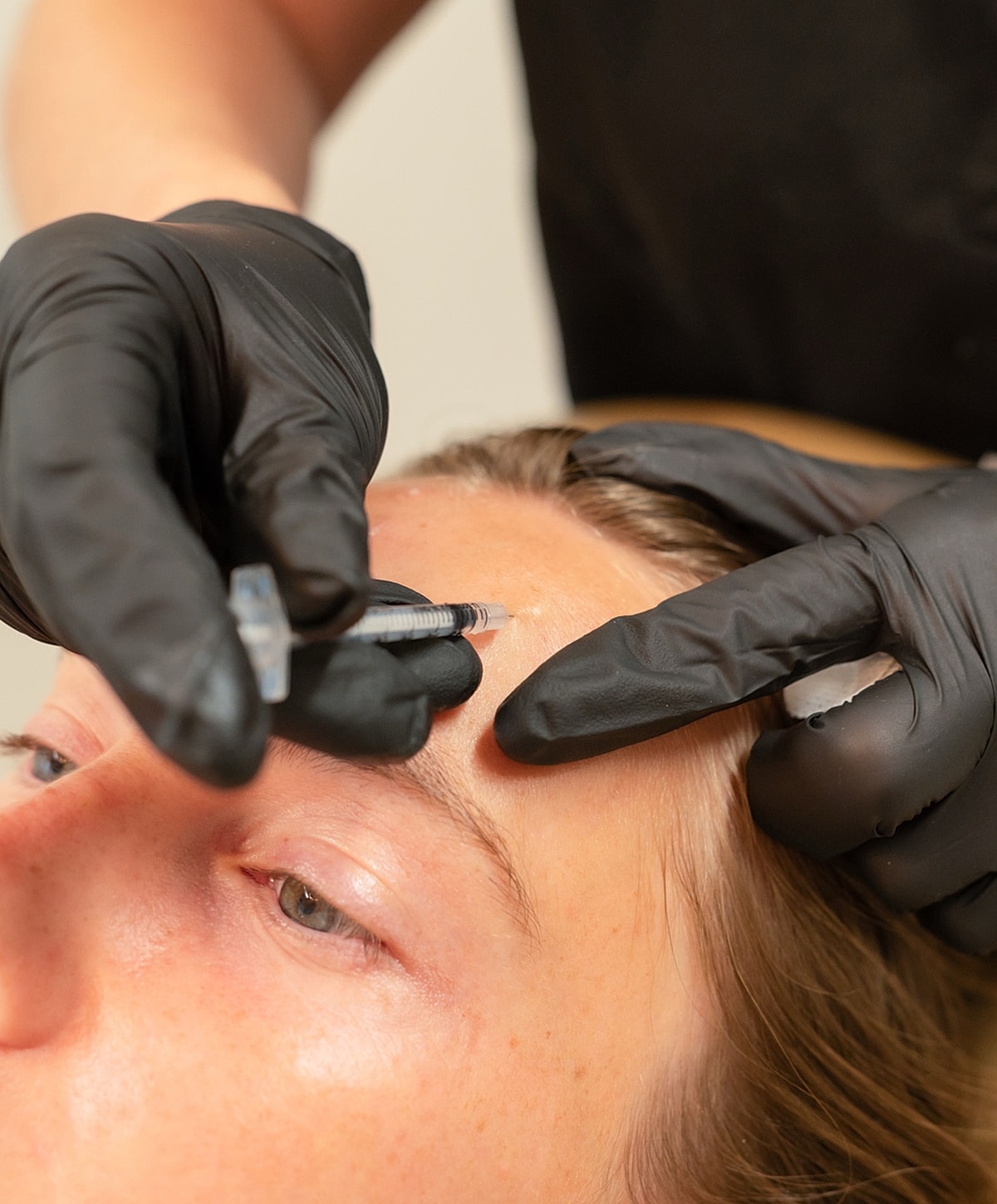 Woman receiving cosmetic injection on forehead.