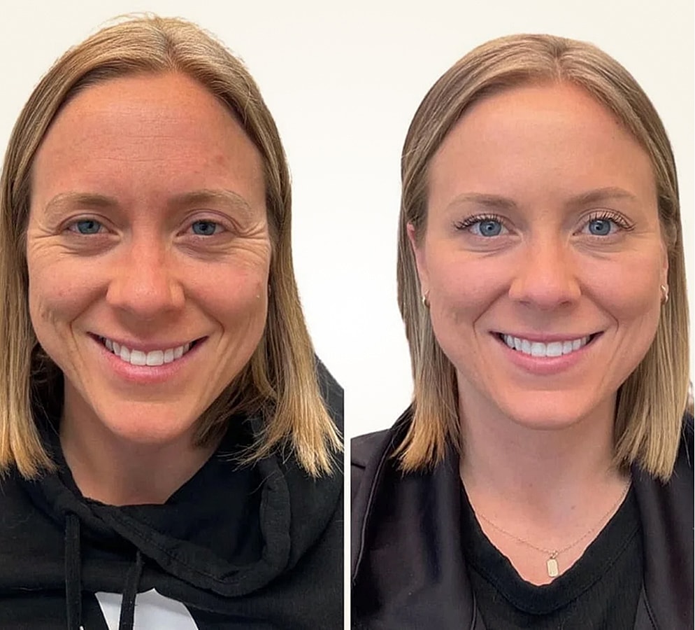 Before and after facial transformation comparison.