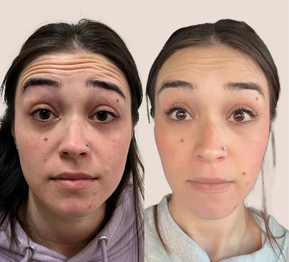 Comparison of facial expressions and appearance.