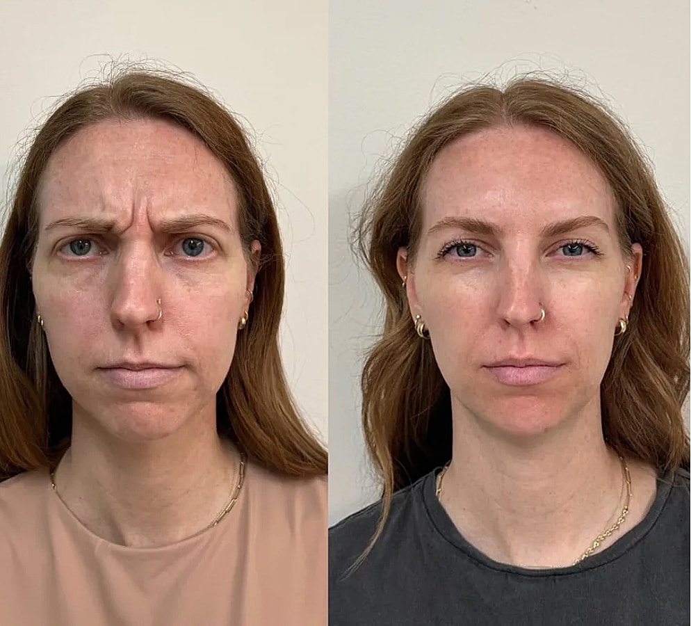 Before and after facial expression change.