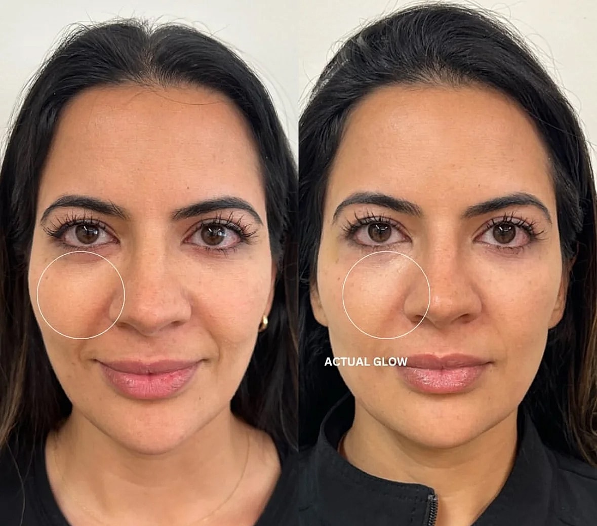 Comparison of skin glow before and after treatment.