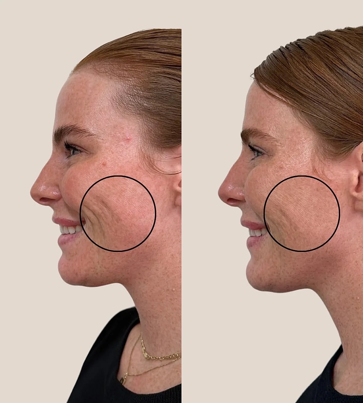 Before and after cosmetic treatment comparison.