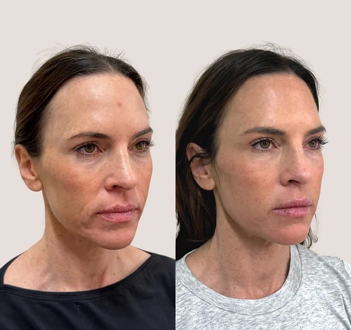 Before and after facial transformation comparison.