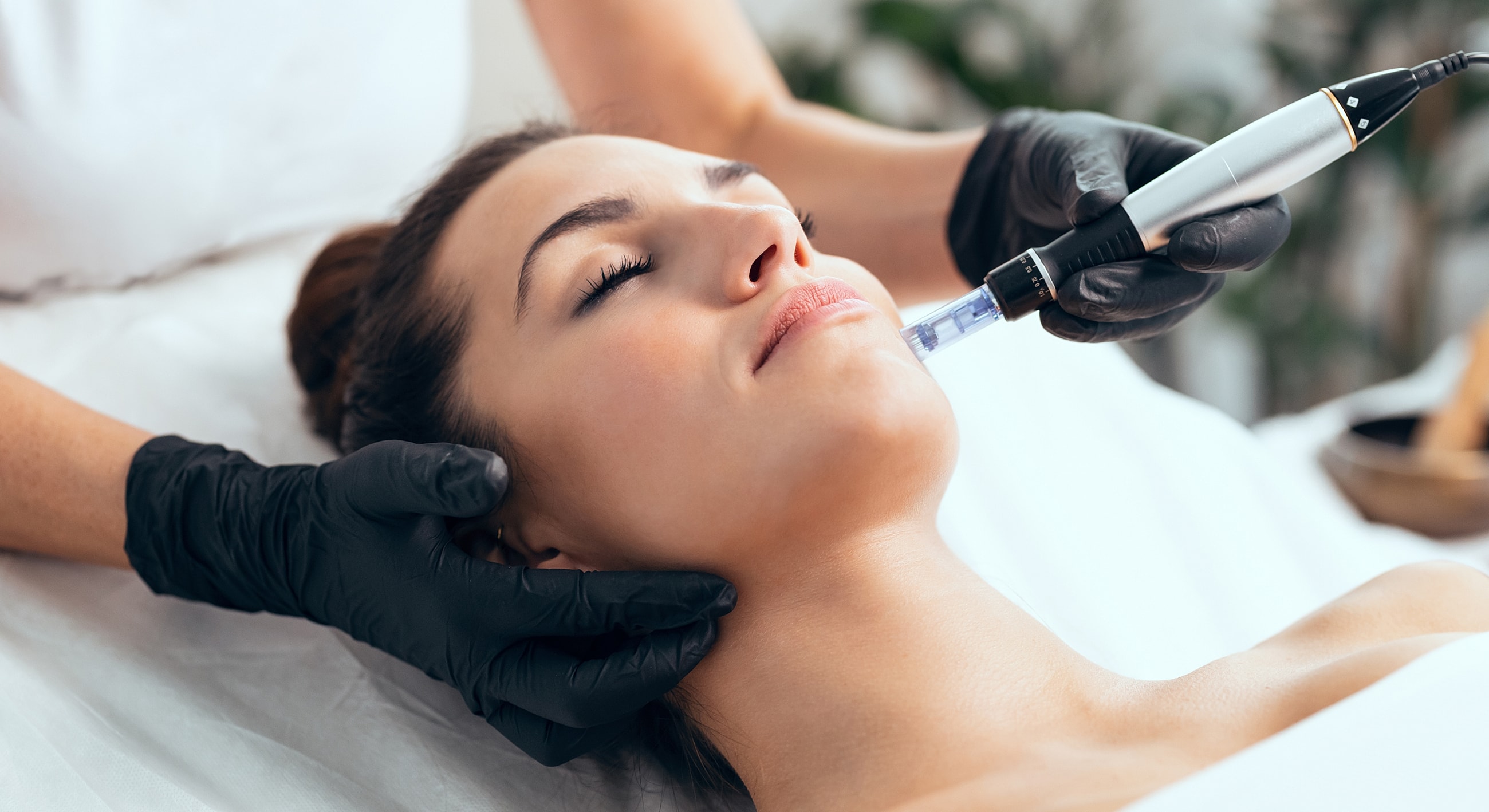 Woman receiving a facial treatment with microneedling.