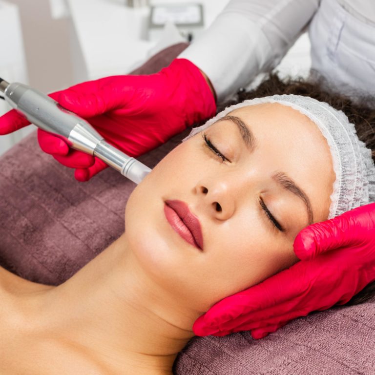 Potenza RF Microneedling in Los angeles CA and Denver CO by Aere Aeshetics