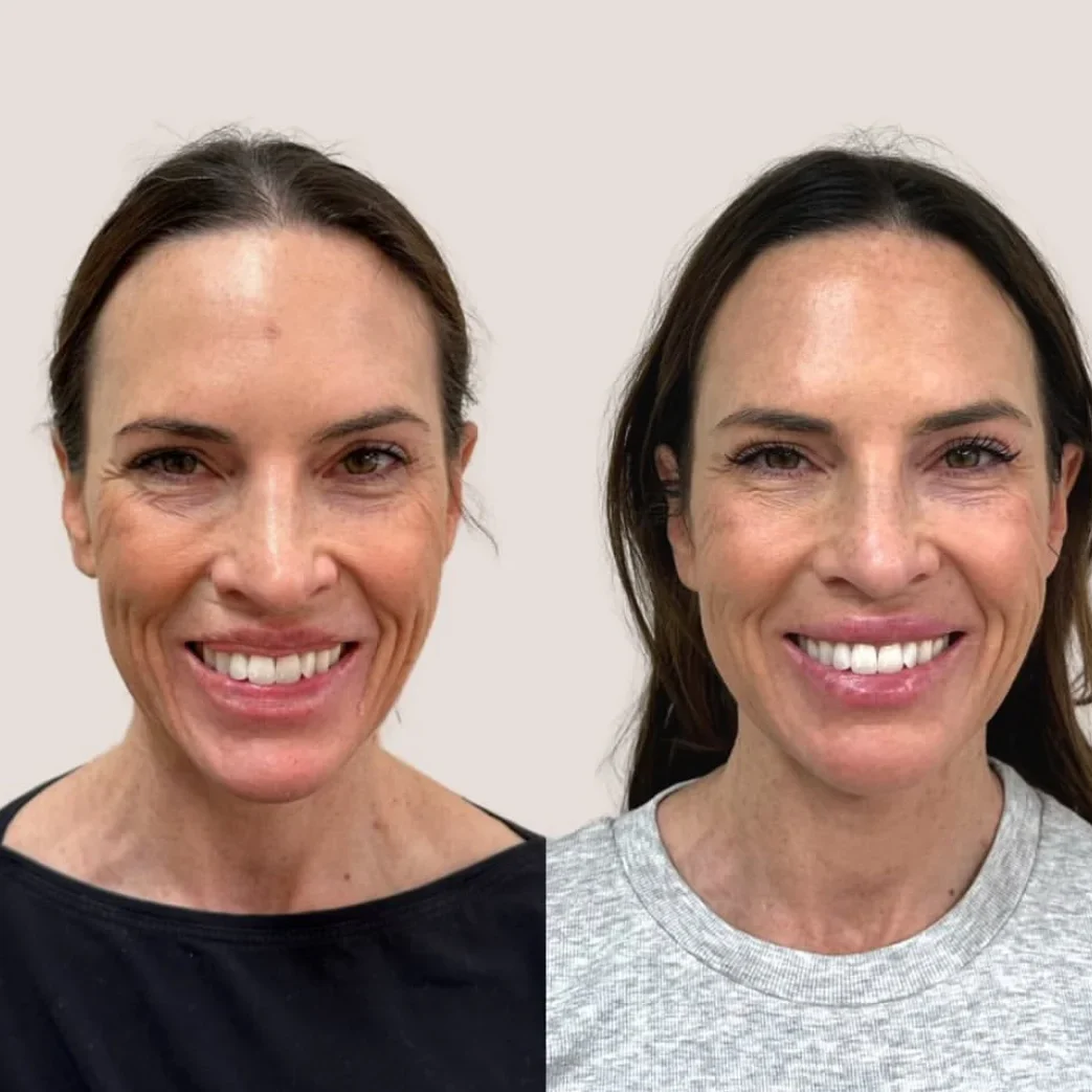 SkinviveBA10