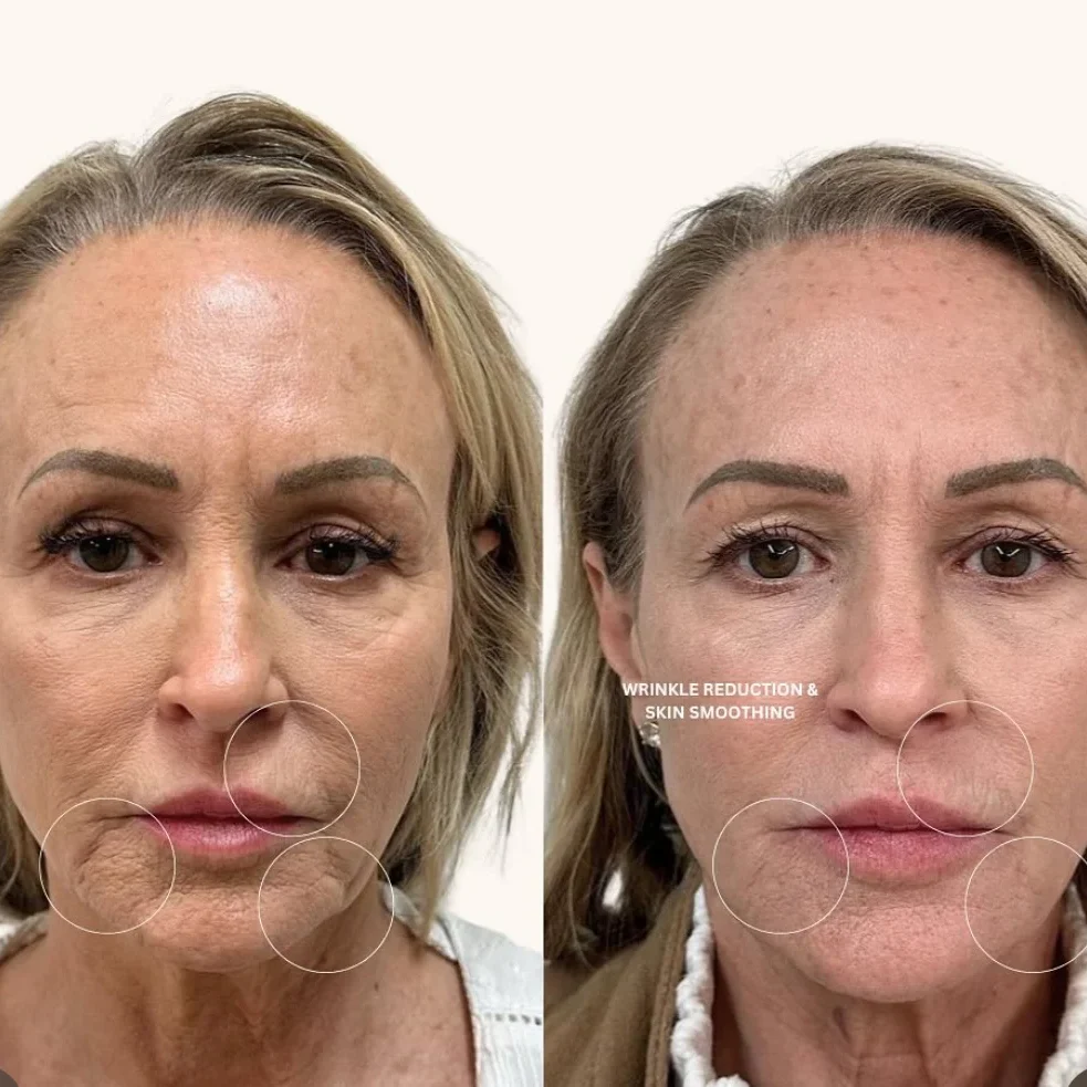 SkinviveBA11