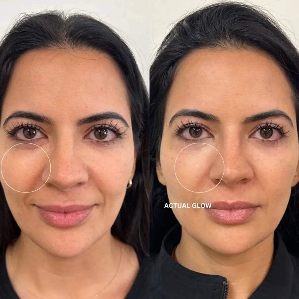 SkinviveBA14