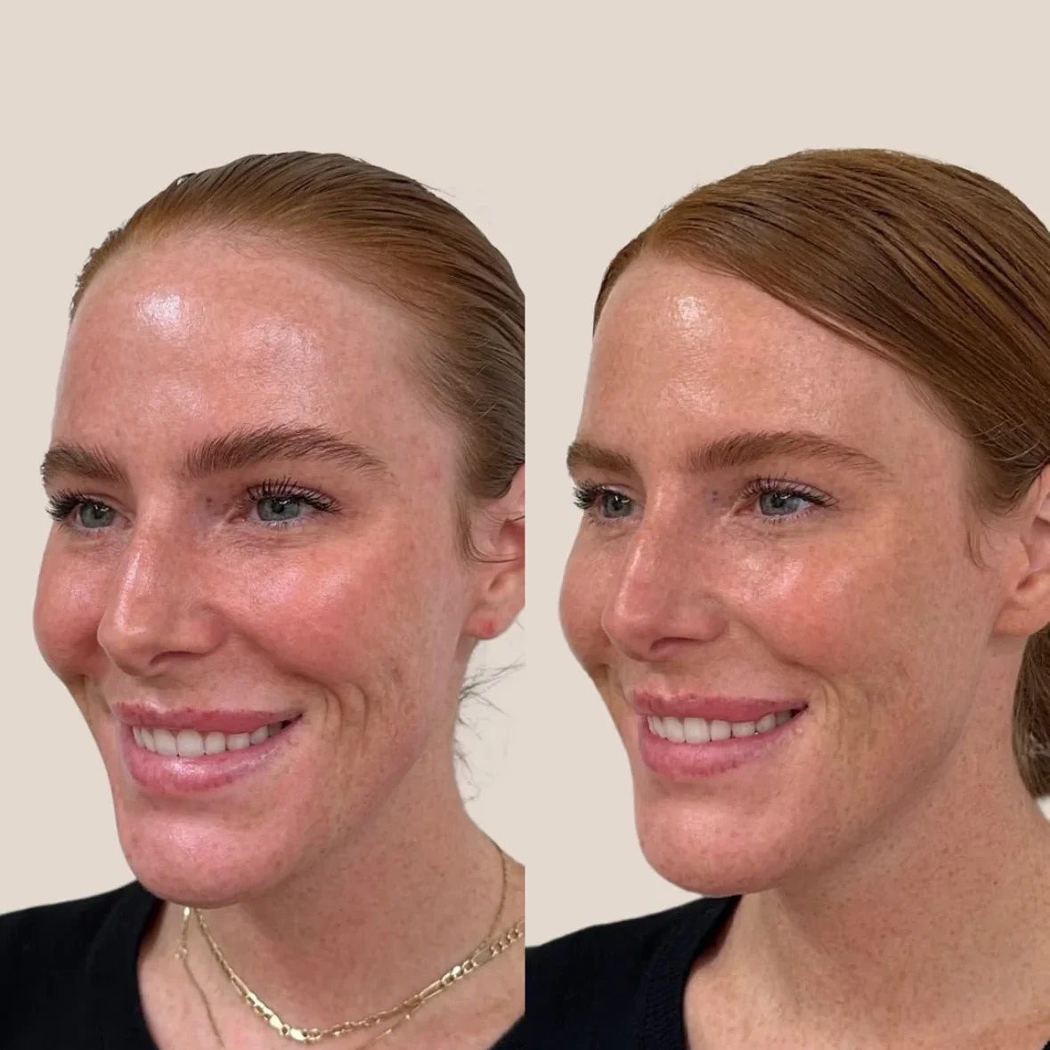 SkinviveBA3