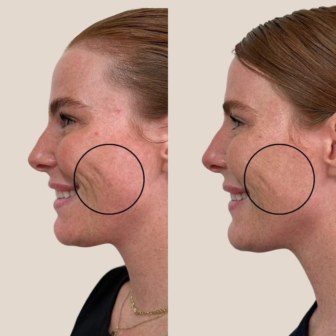 SkinviveBA4