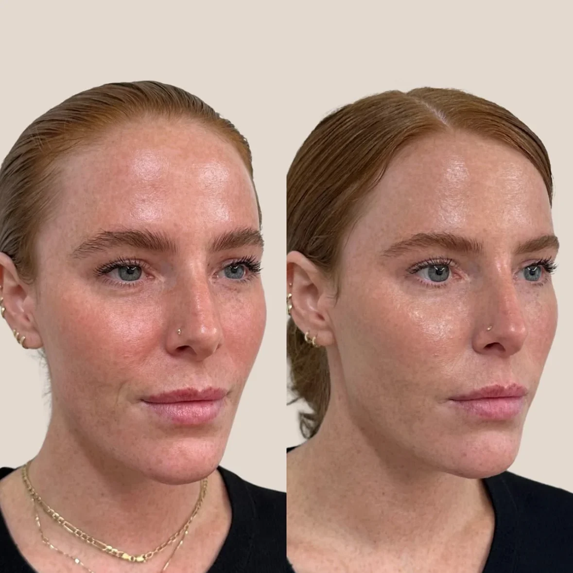 SkinviveBA5