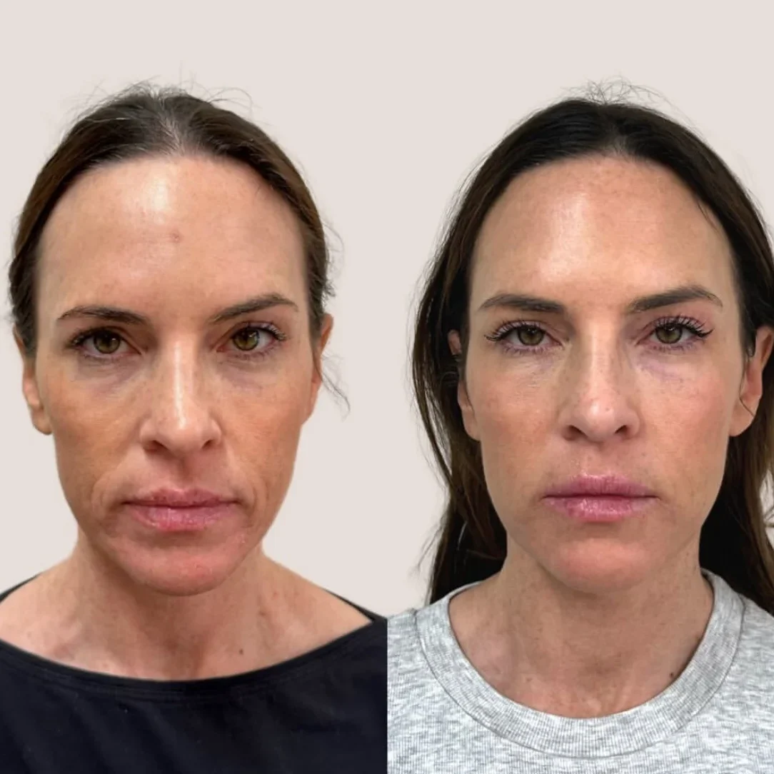 SkinviveBA6