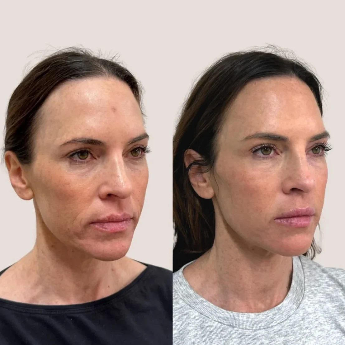 SkinviveBA8