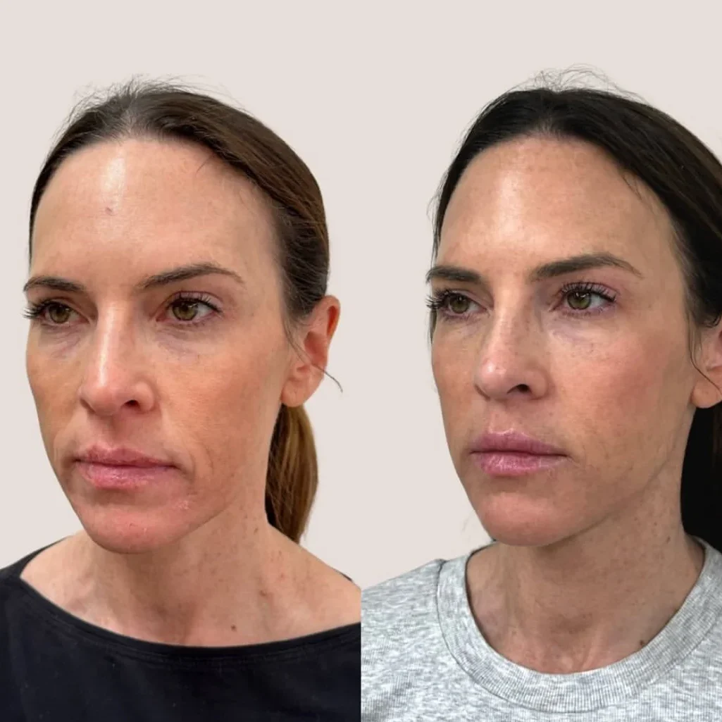SkinviveBA9
