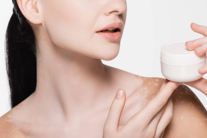: Cosmelan Peel: What are the Conditions Treated and Risks Associated with It